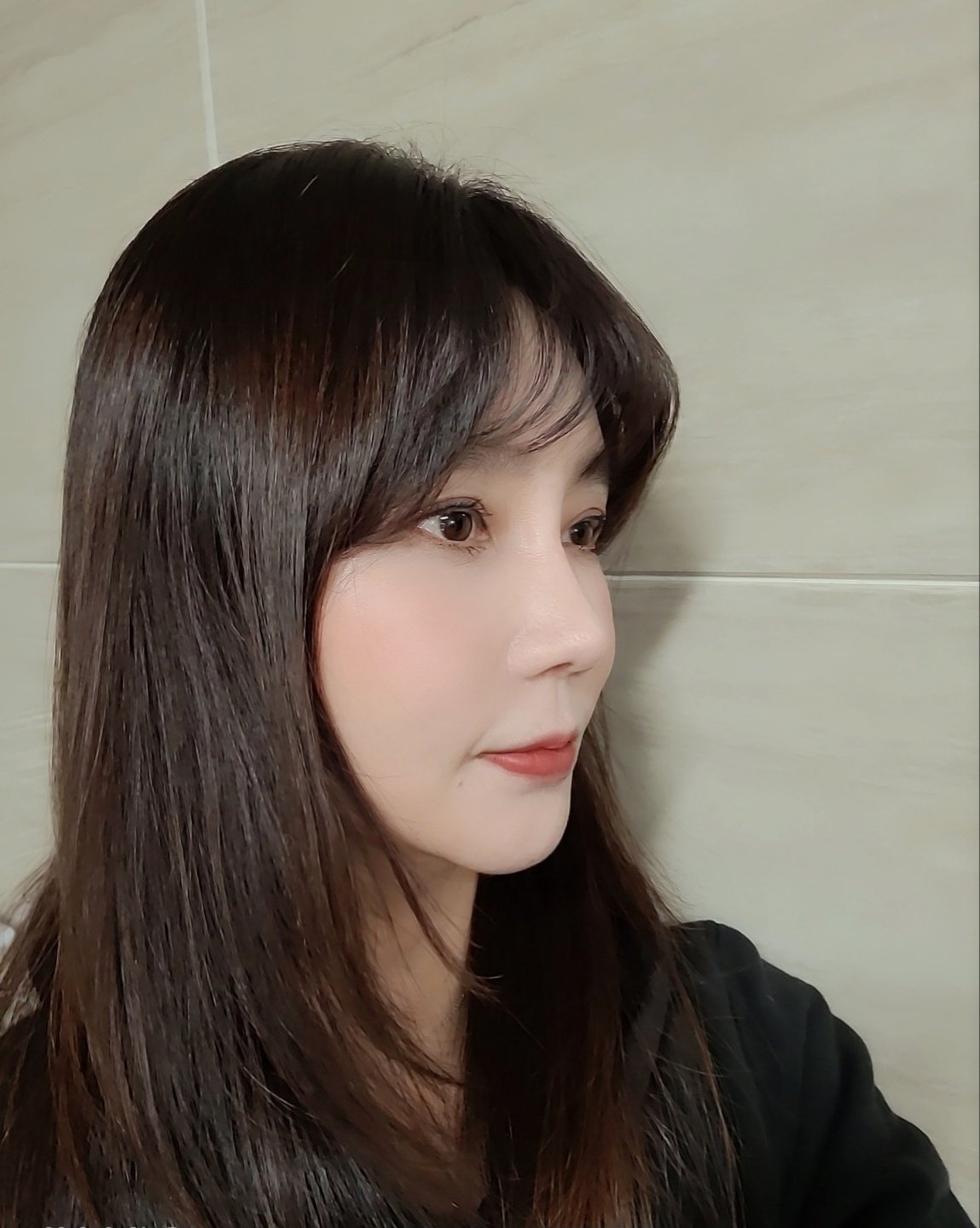 수술후기이미지