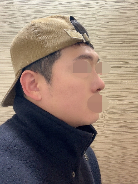 수술후기이미지