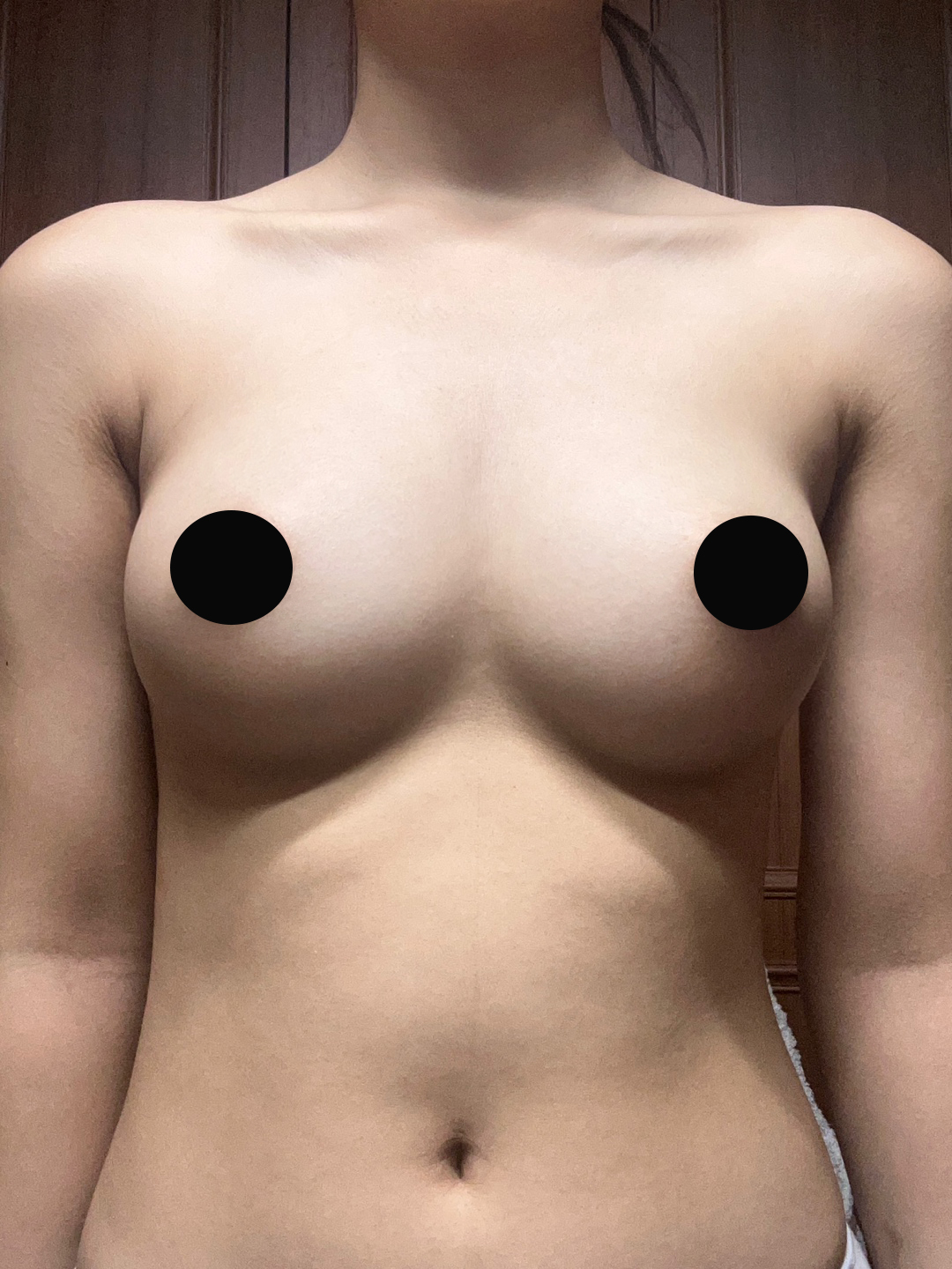 수술후기이미지