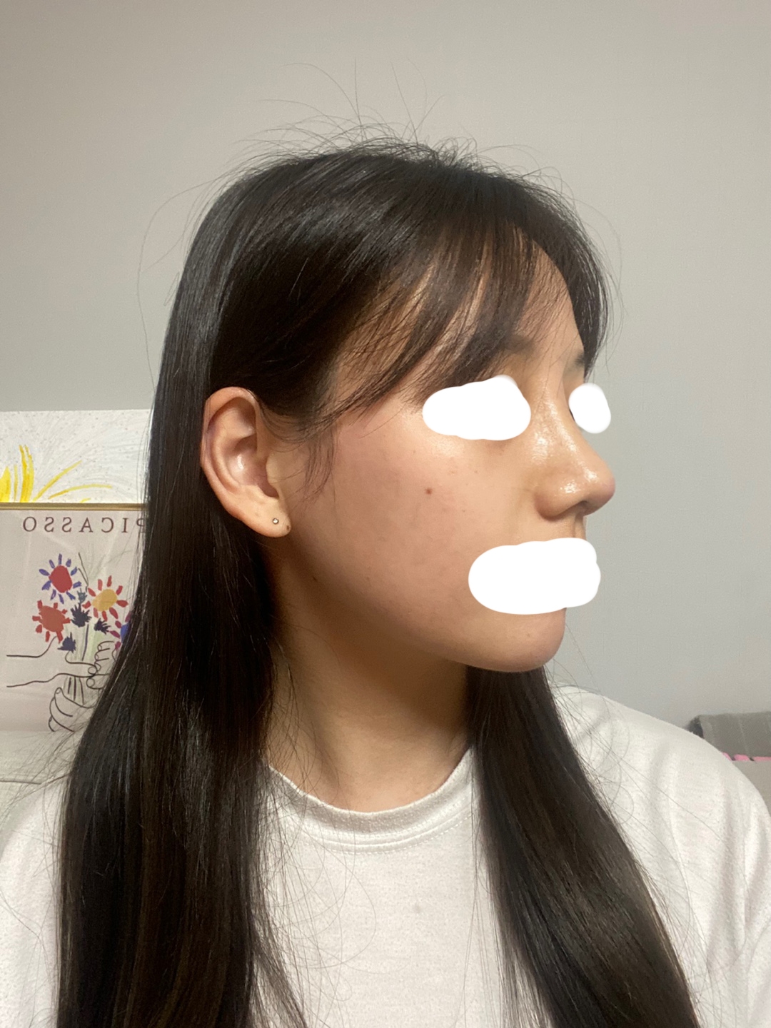 수술후기이미지