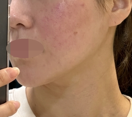 수술후기이미지