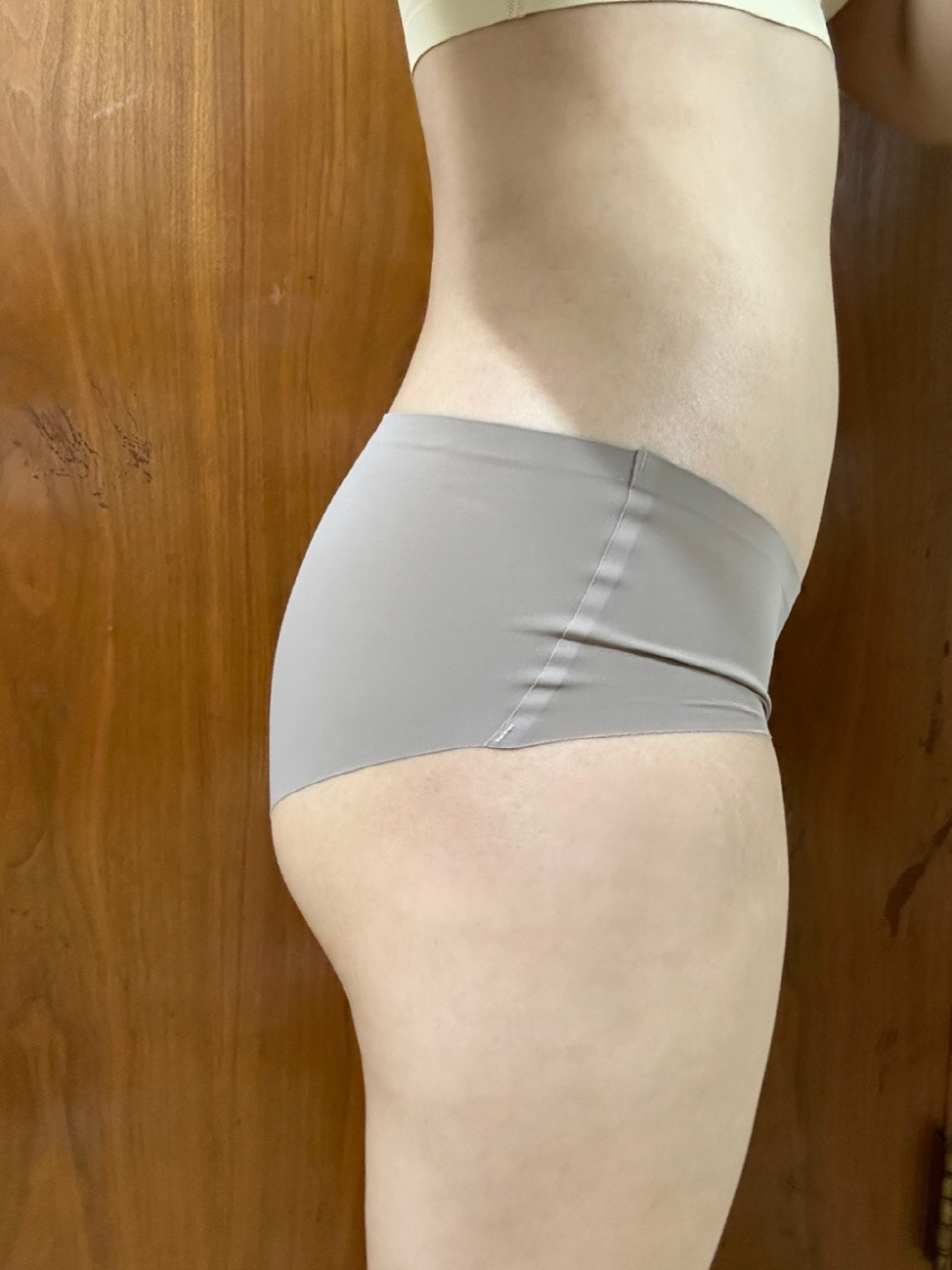 수술후기이미지