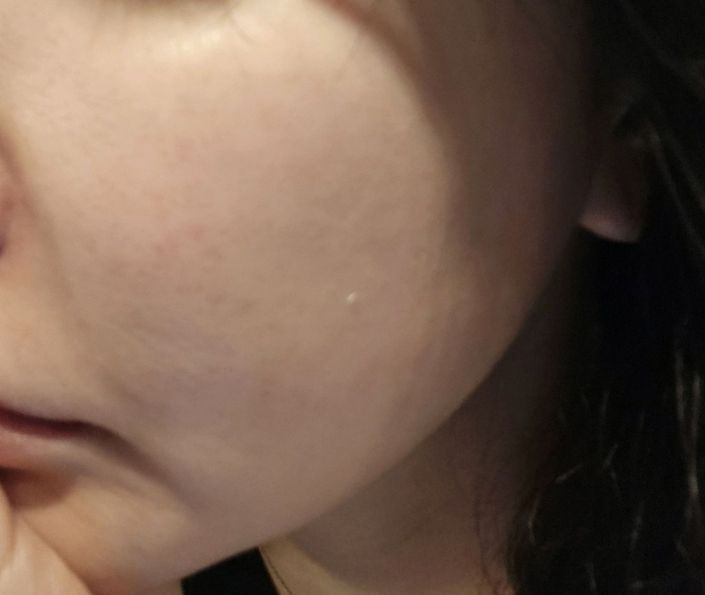 수술후기이미지