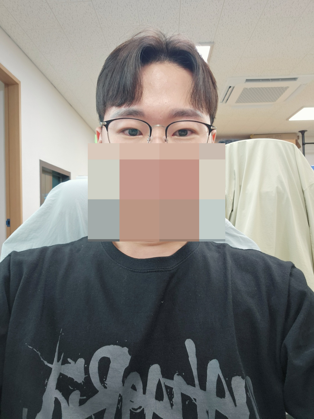 수술후기이미지