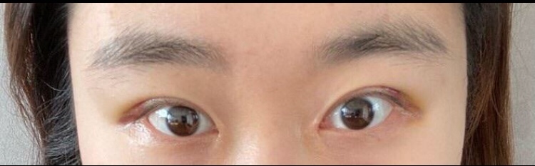 수술후기이미지