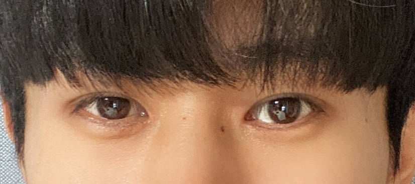 수술후기이미지