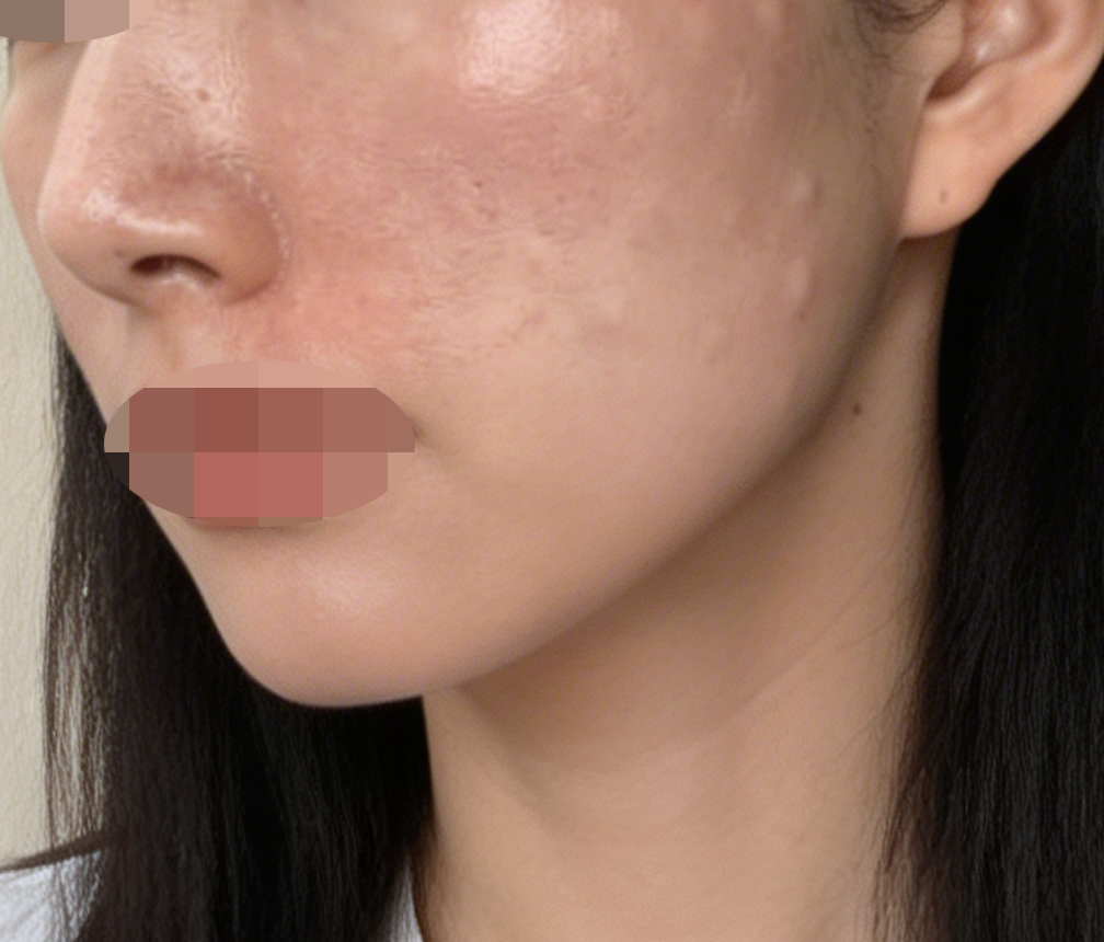 수술후기이미지