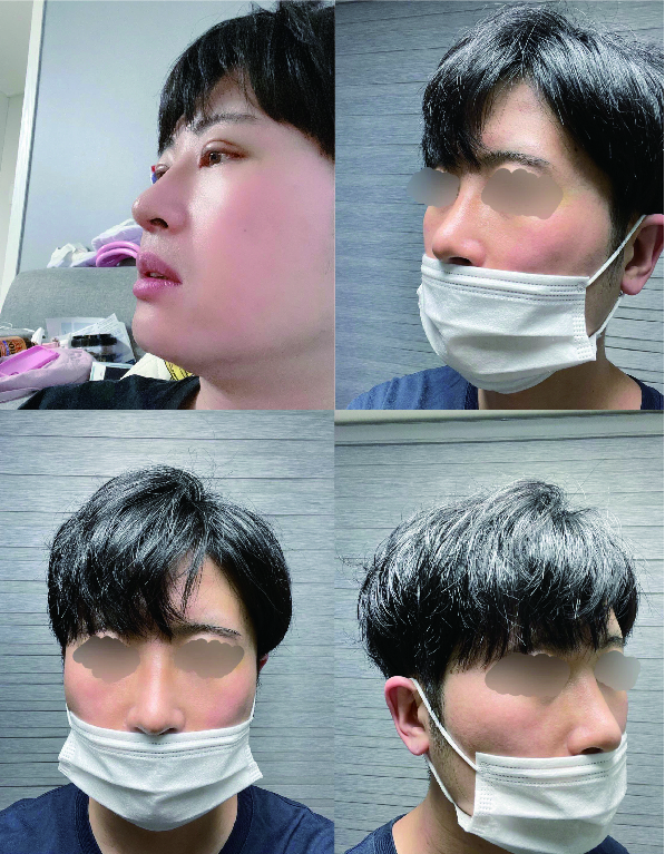 수술후기이미지