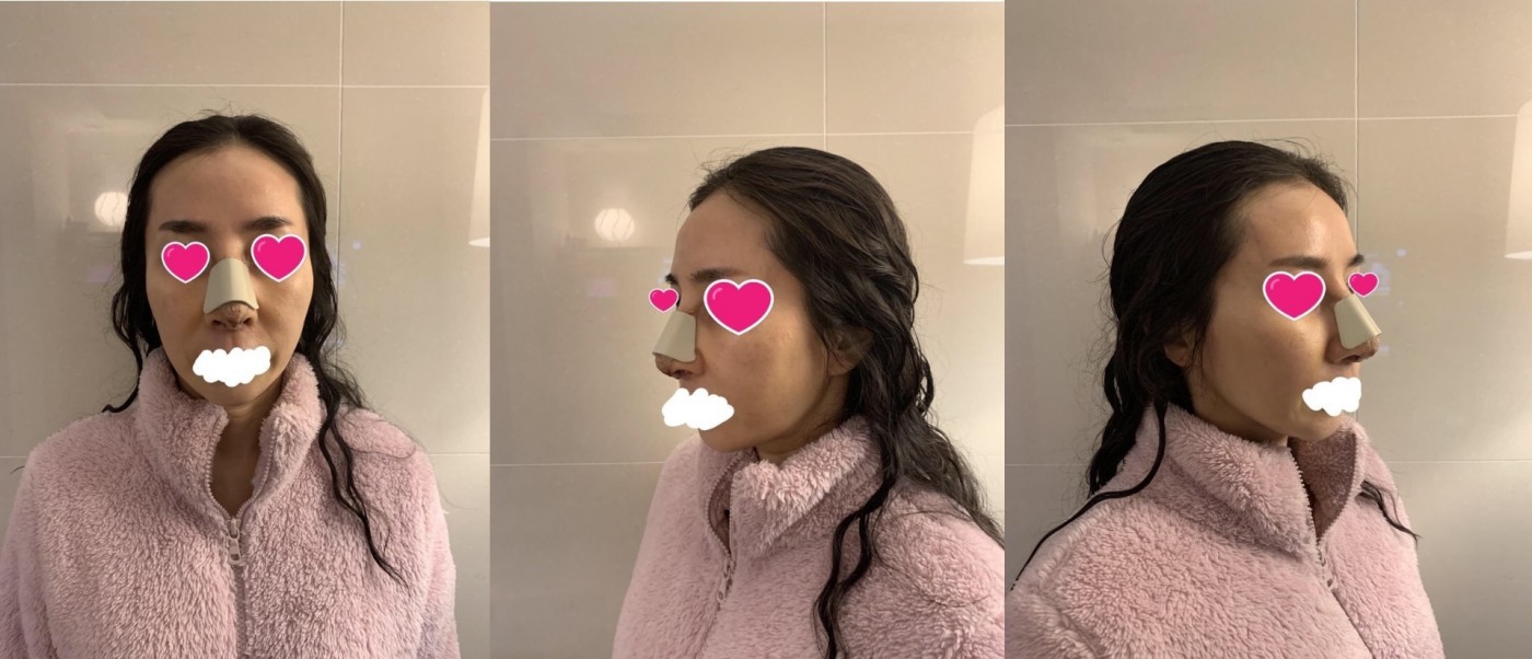 수술후기이미지