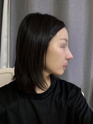 수술후기이미지