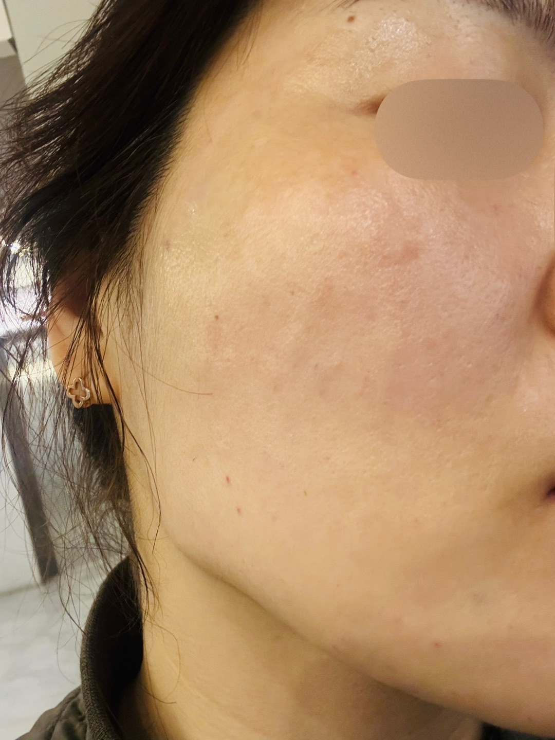 수술후기이미지