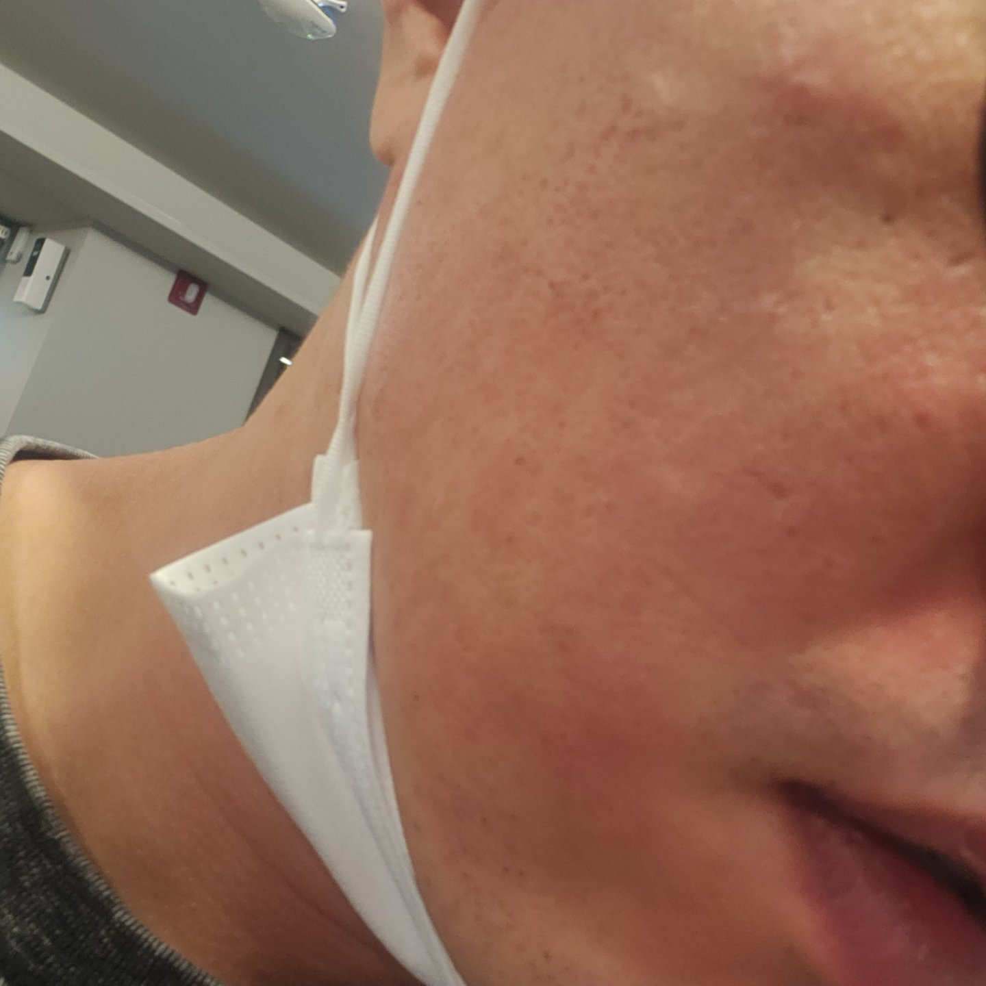 수술후기이미지