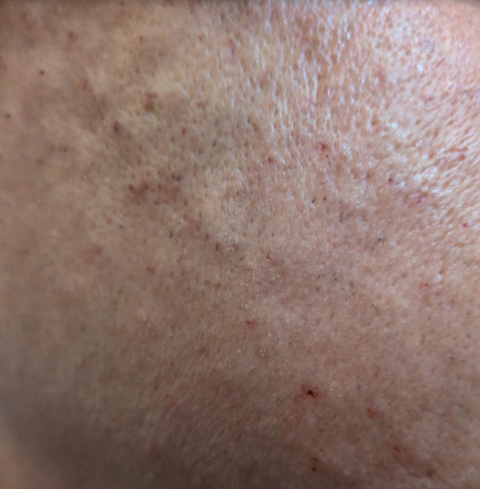 수술후기이미지