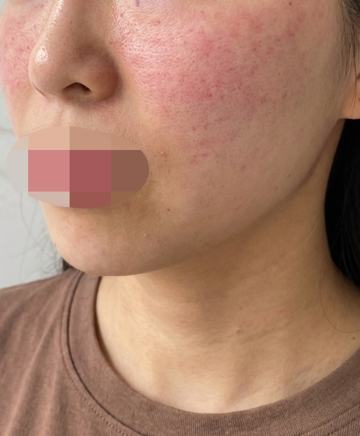 수술후기이미지