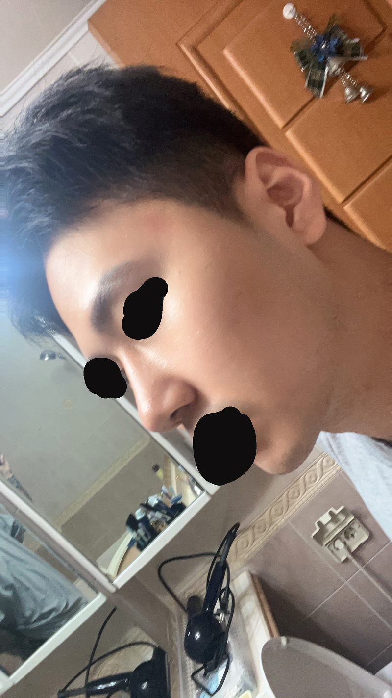 수술후기이미지