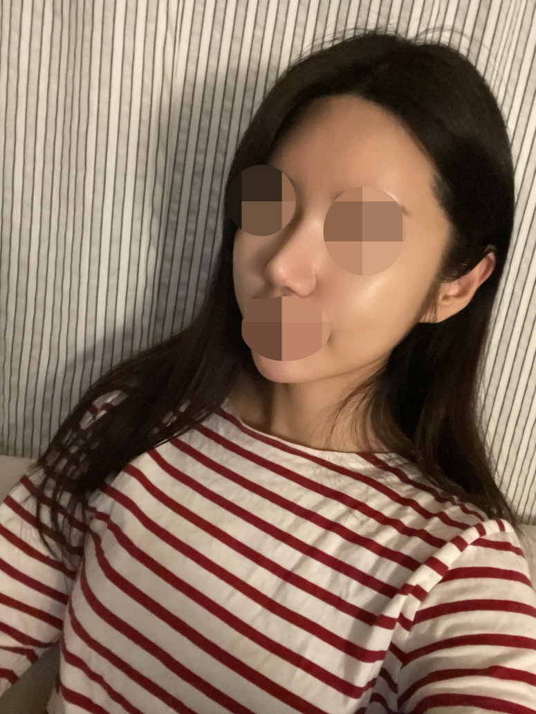 수술후기이미지