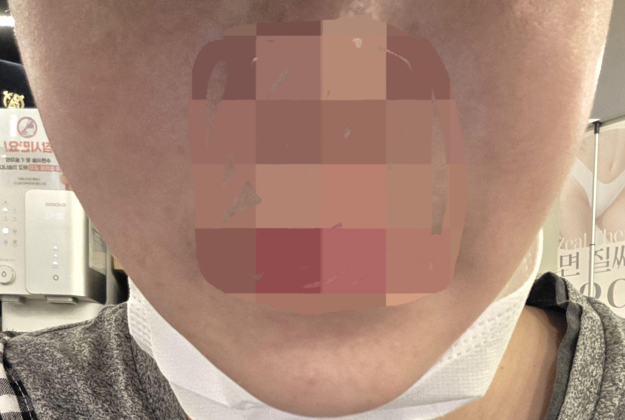 수술후기이미지