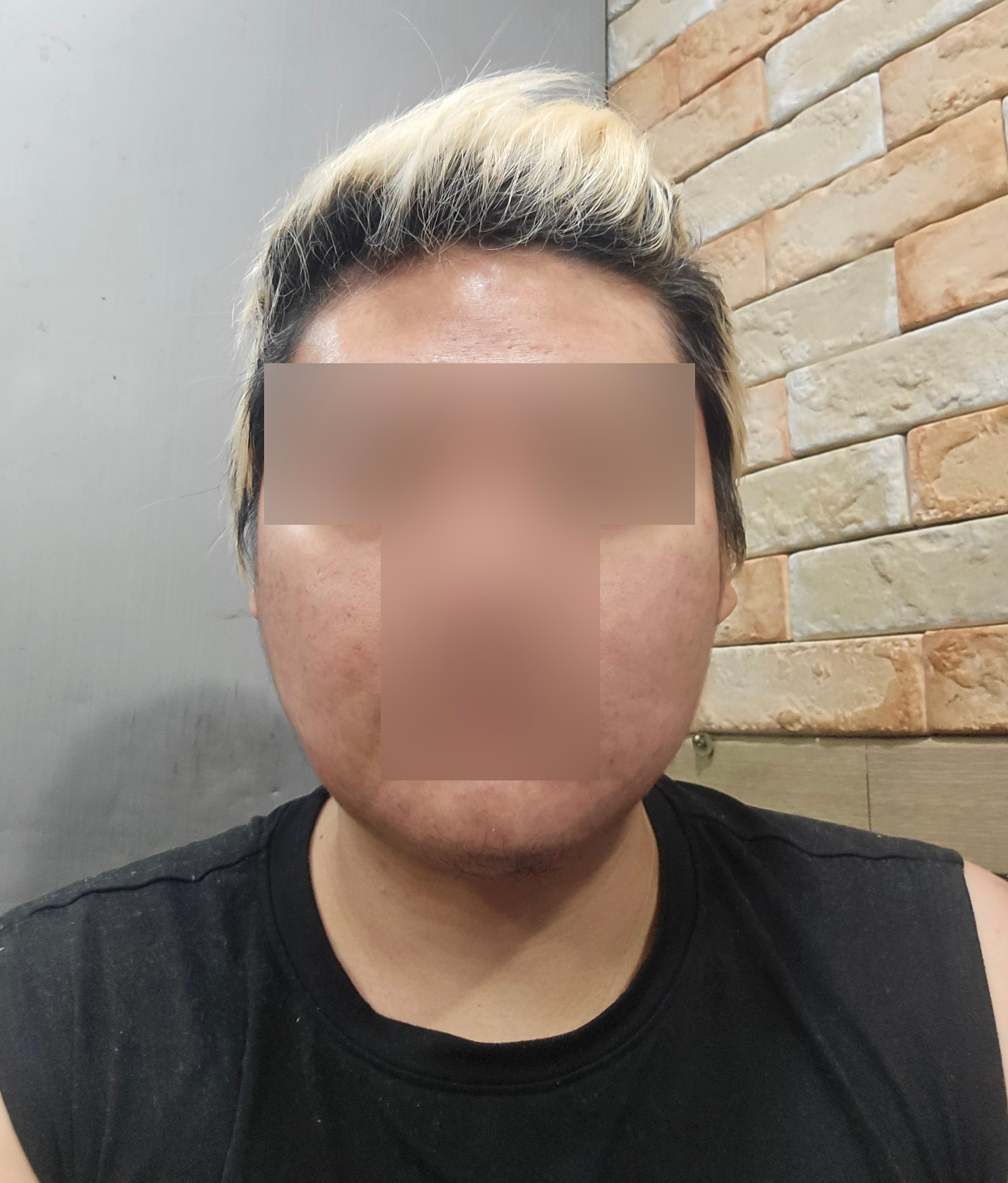 수술후기이미지