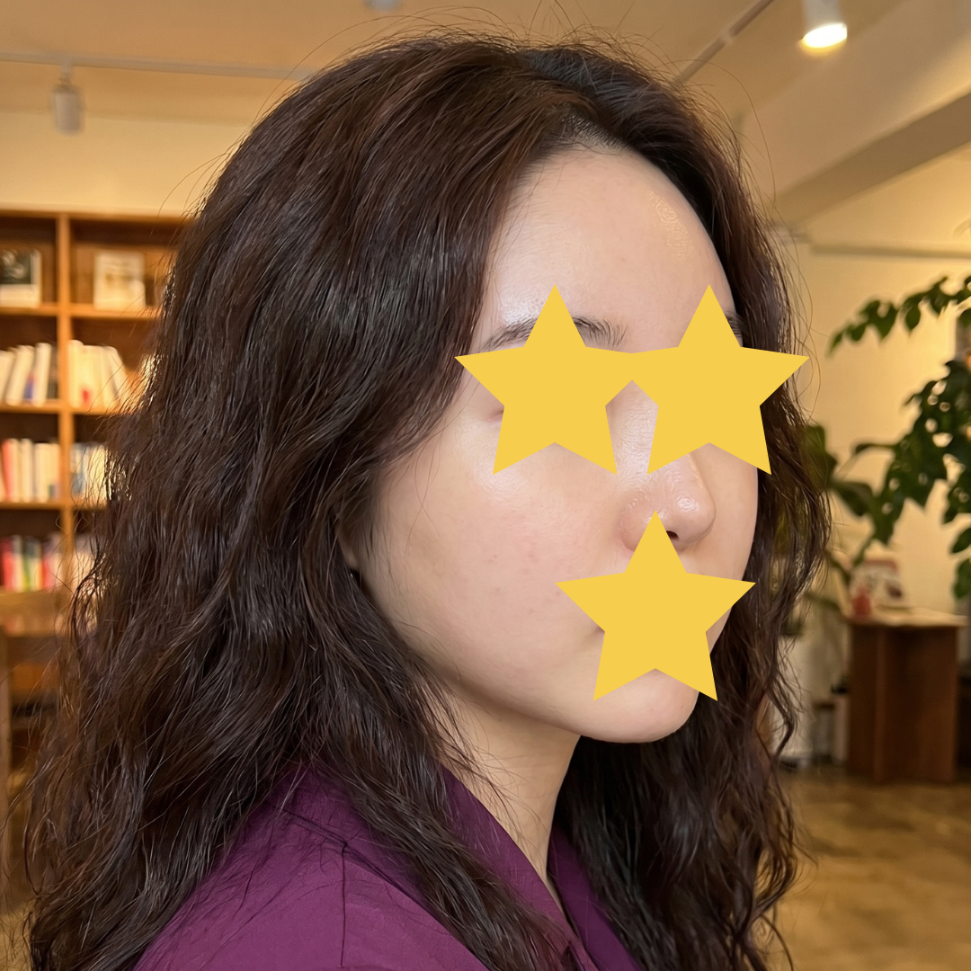 수술후기이미지