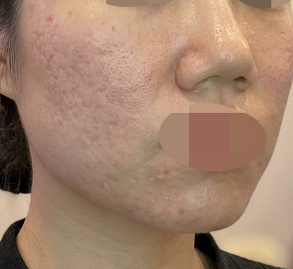 수술후기이미지