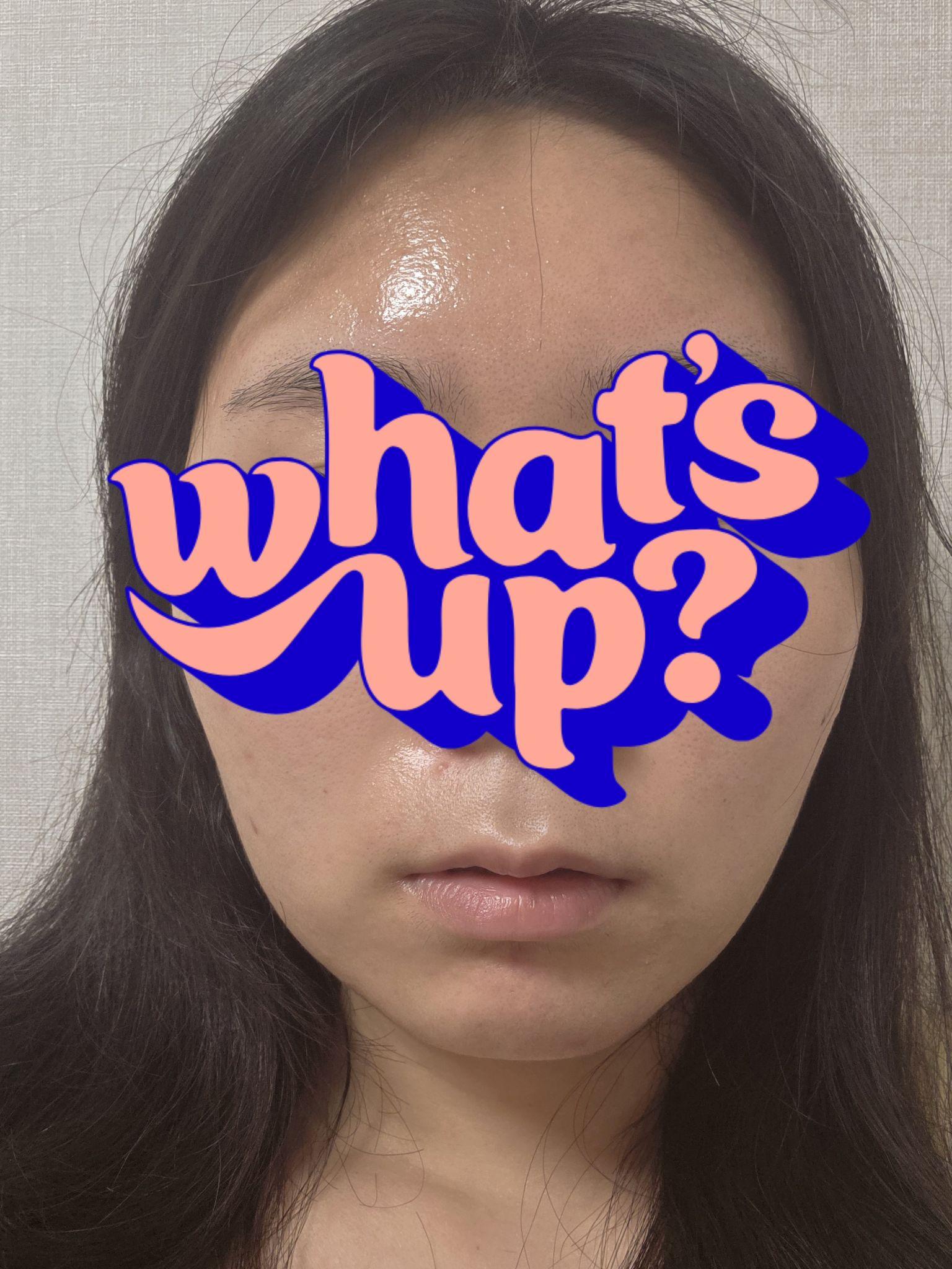 수술후기이미지