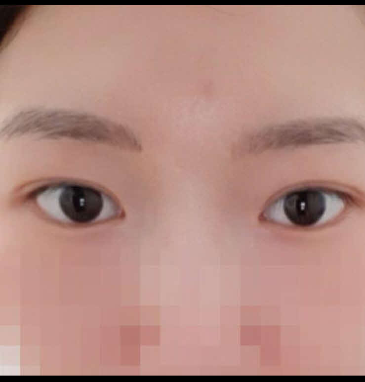 수술후기이미지