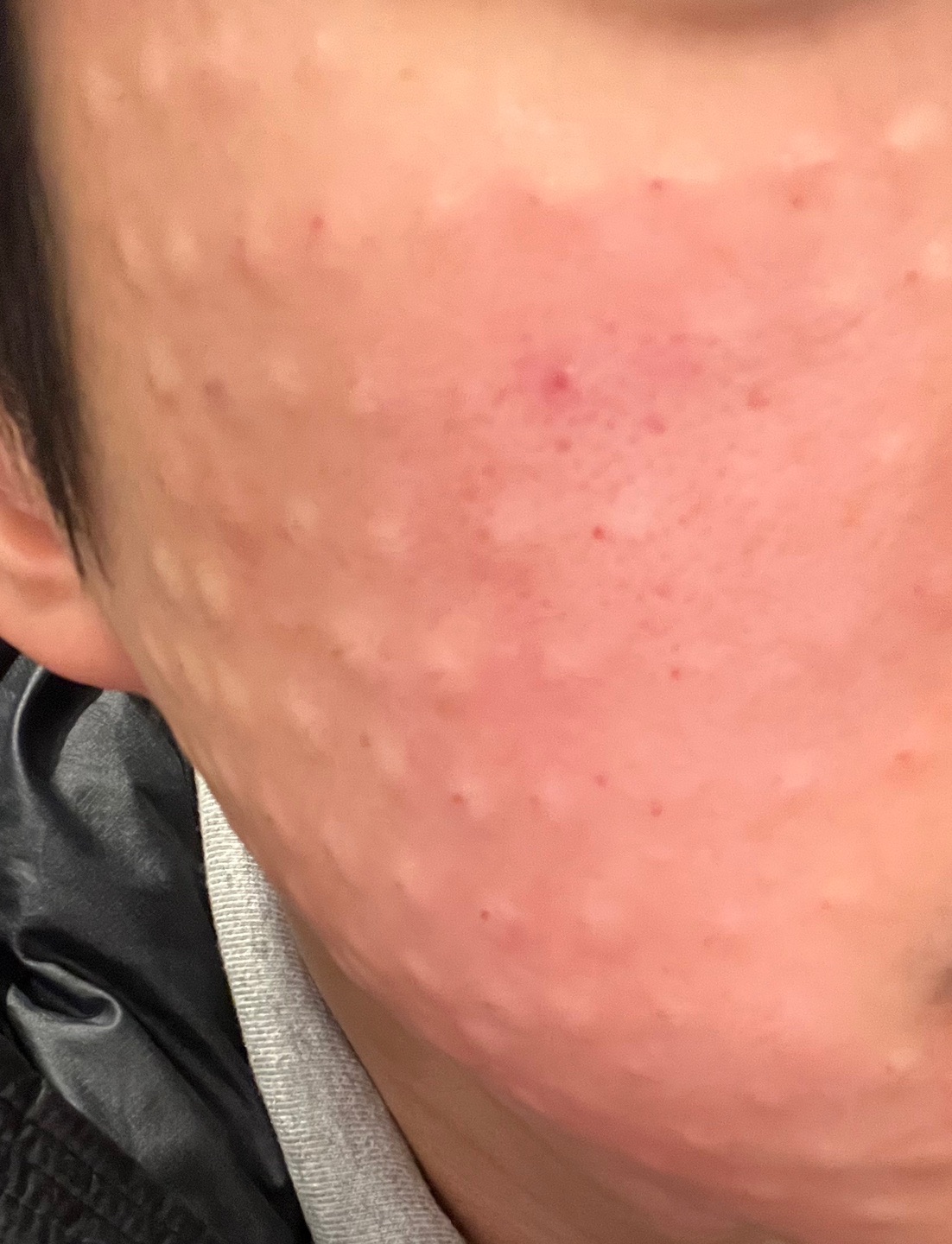 수술후기이미지