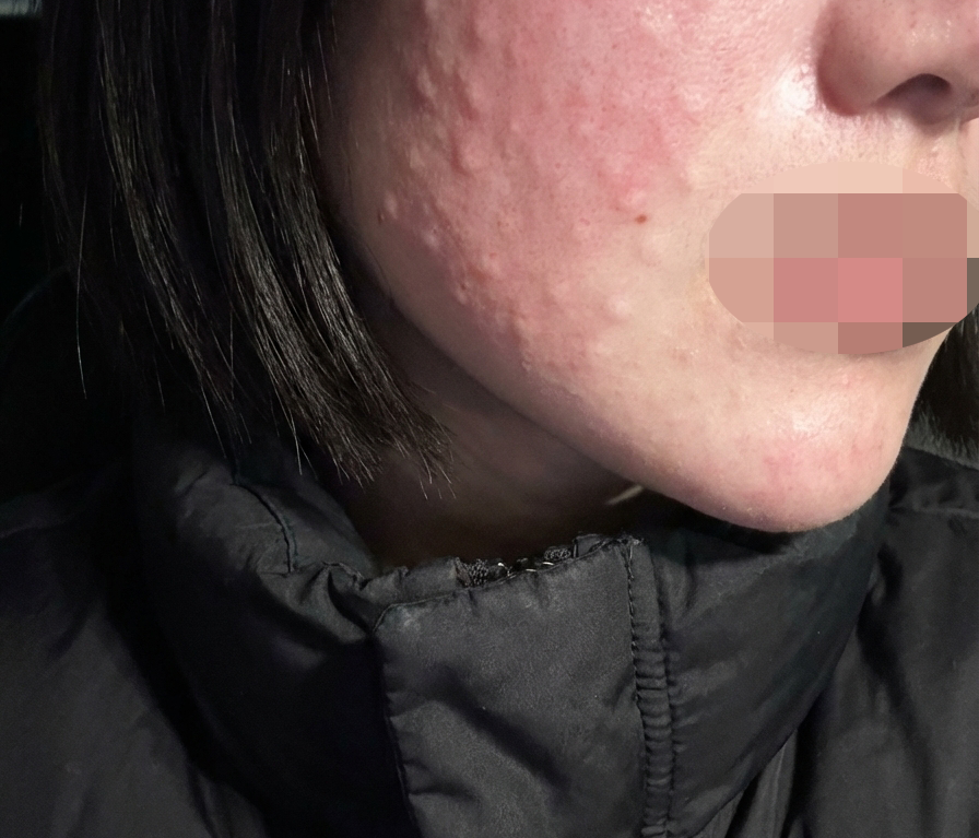 수술후기이미지