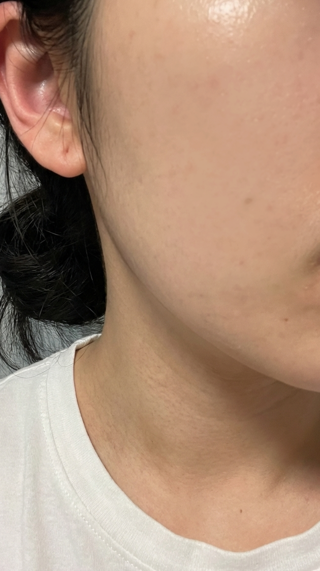 수술후기이미지