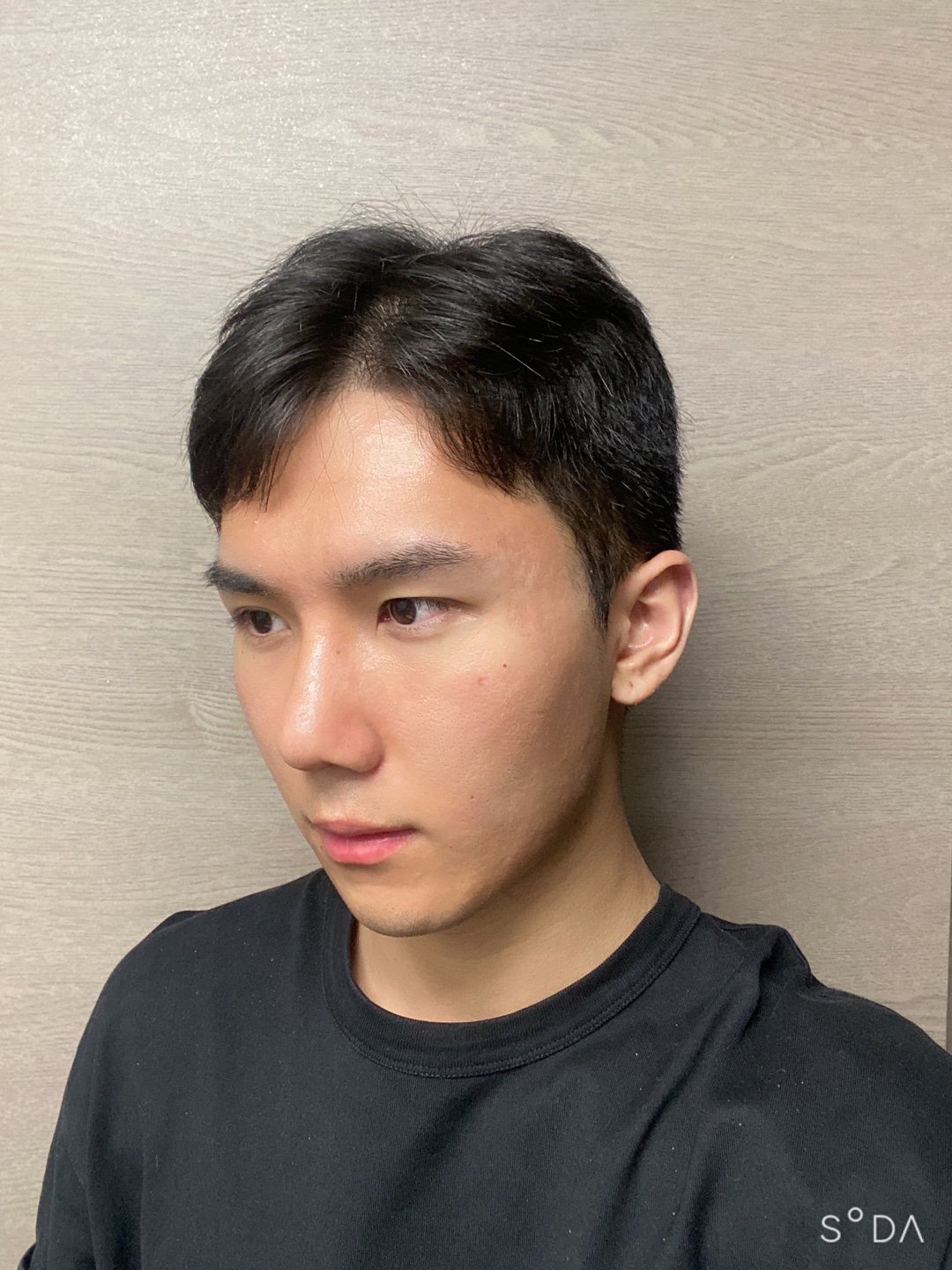 수술후기이미지