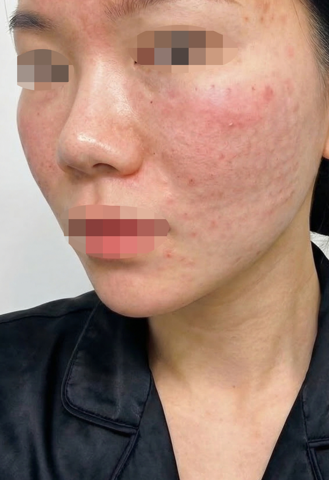 수술후기이미지