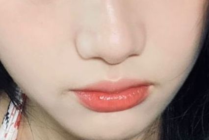 수술후기이미지