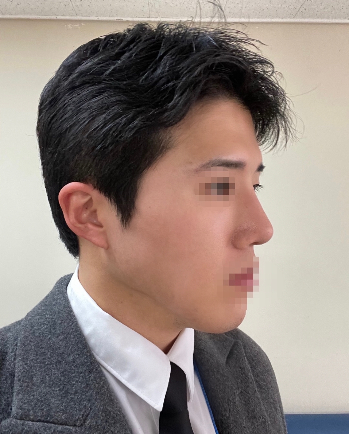 수술후기이미지