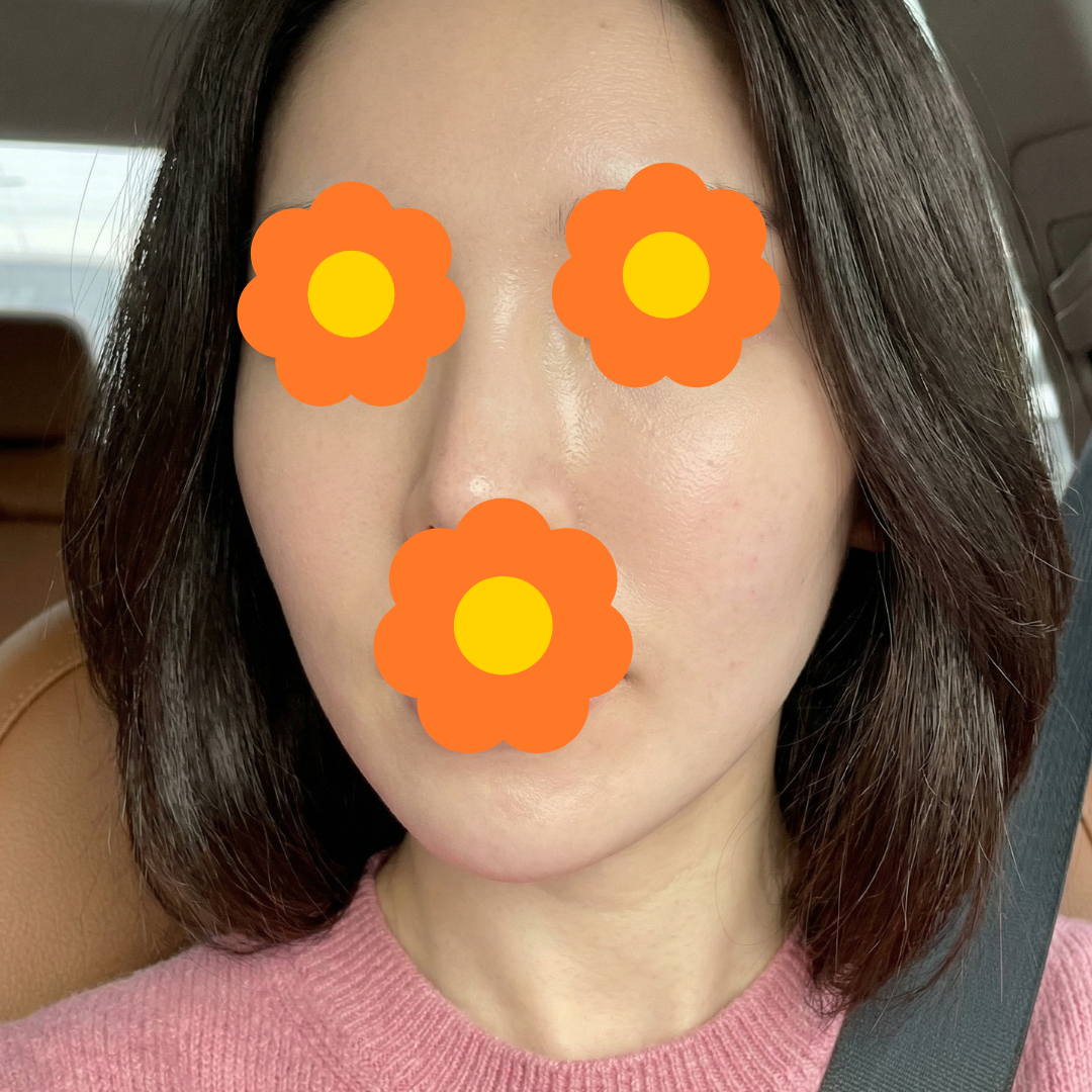 수술후기이미지