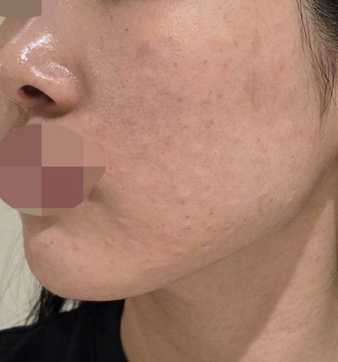 수술후기이미지