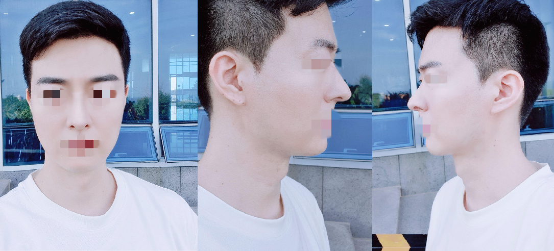 수술후기이미지