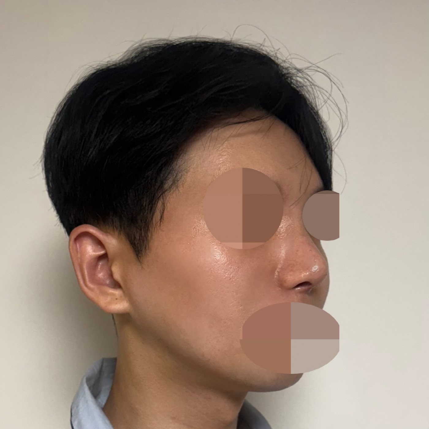 수술후기이미지