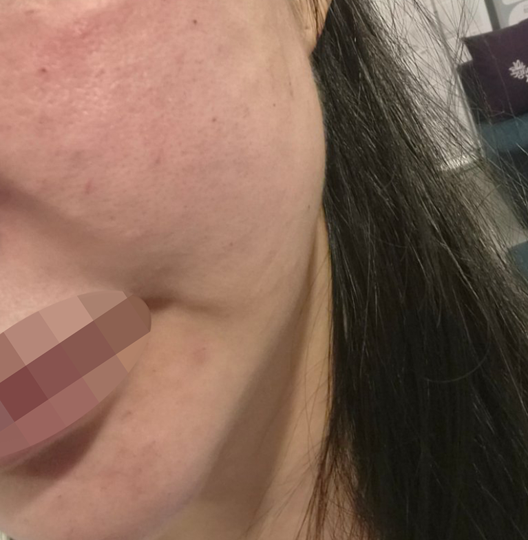 수술후기이미지