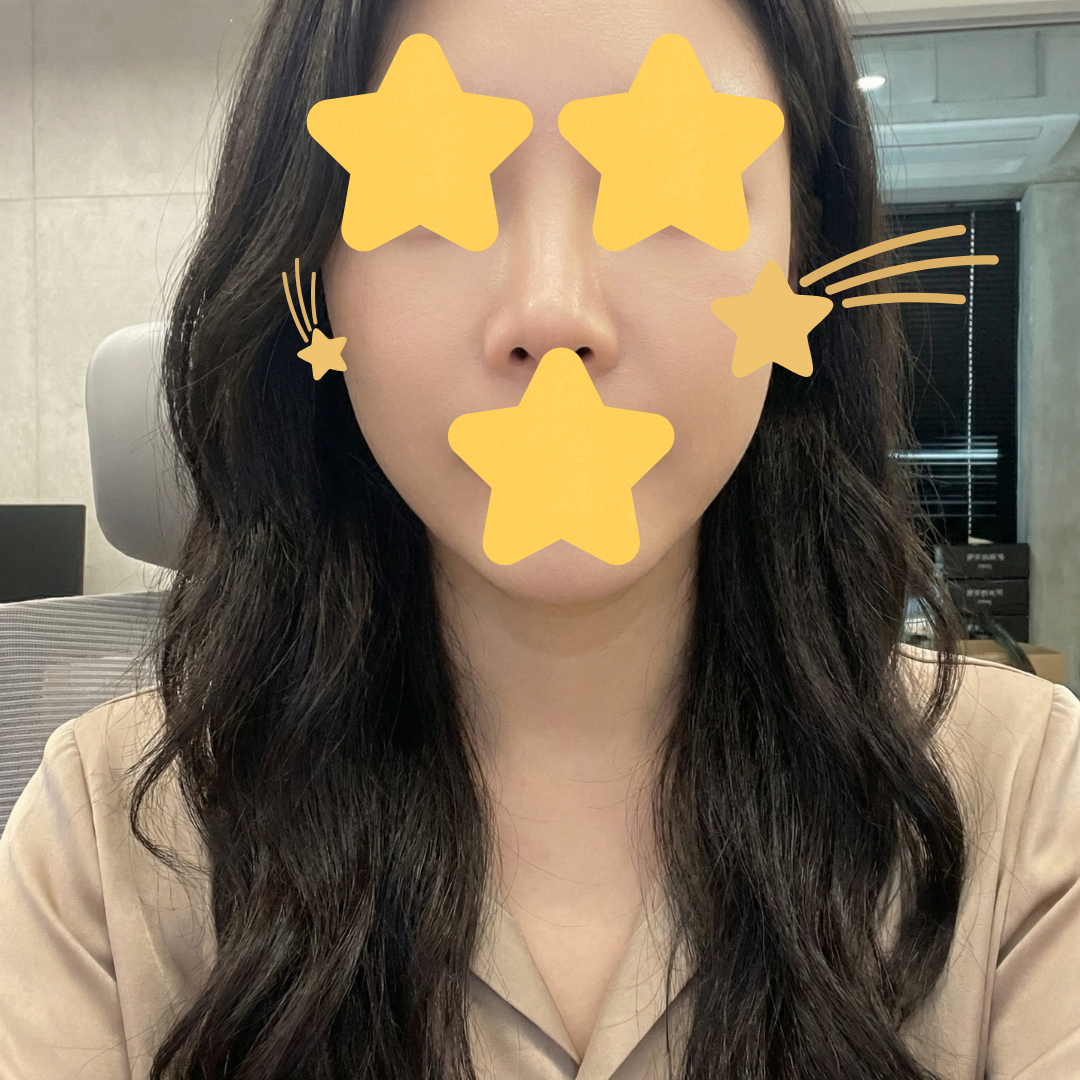 수술후기이미지