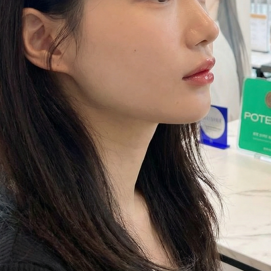 수술후기이미지