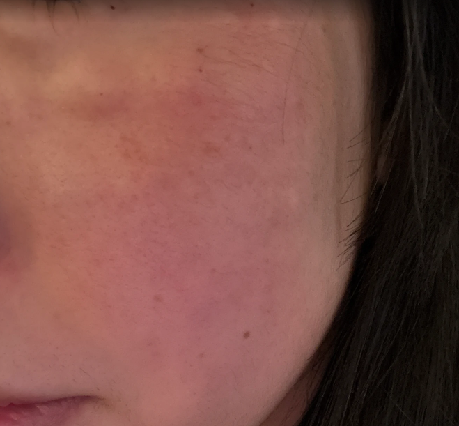 수술후기이미지