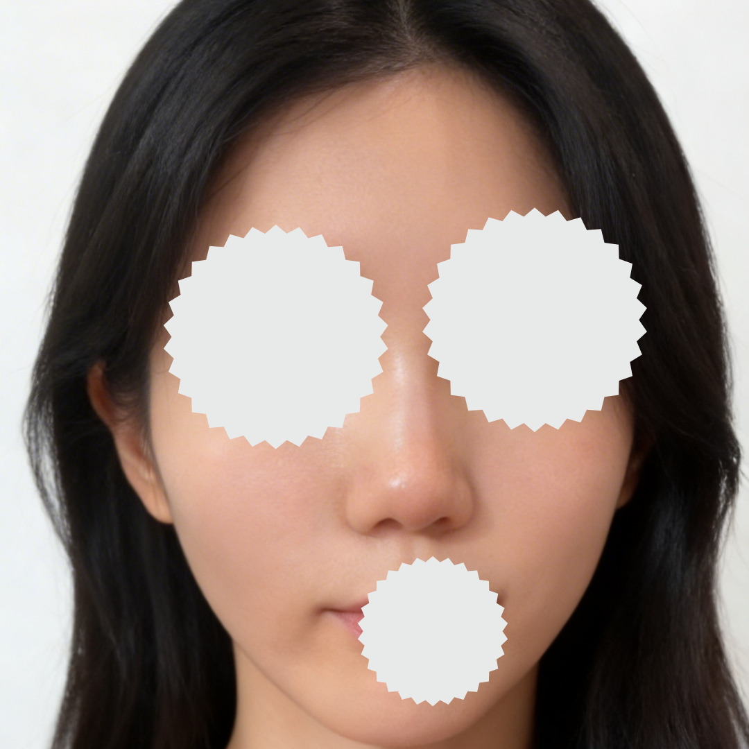 수술후기이미지