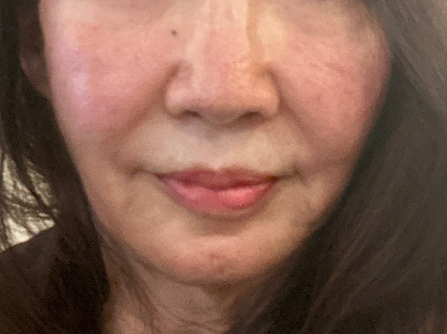 수술후기이미지