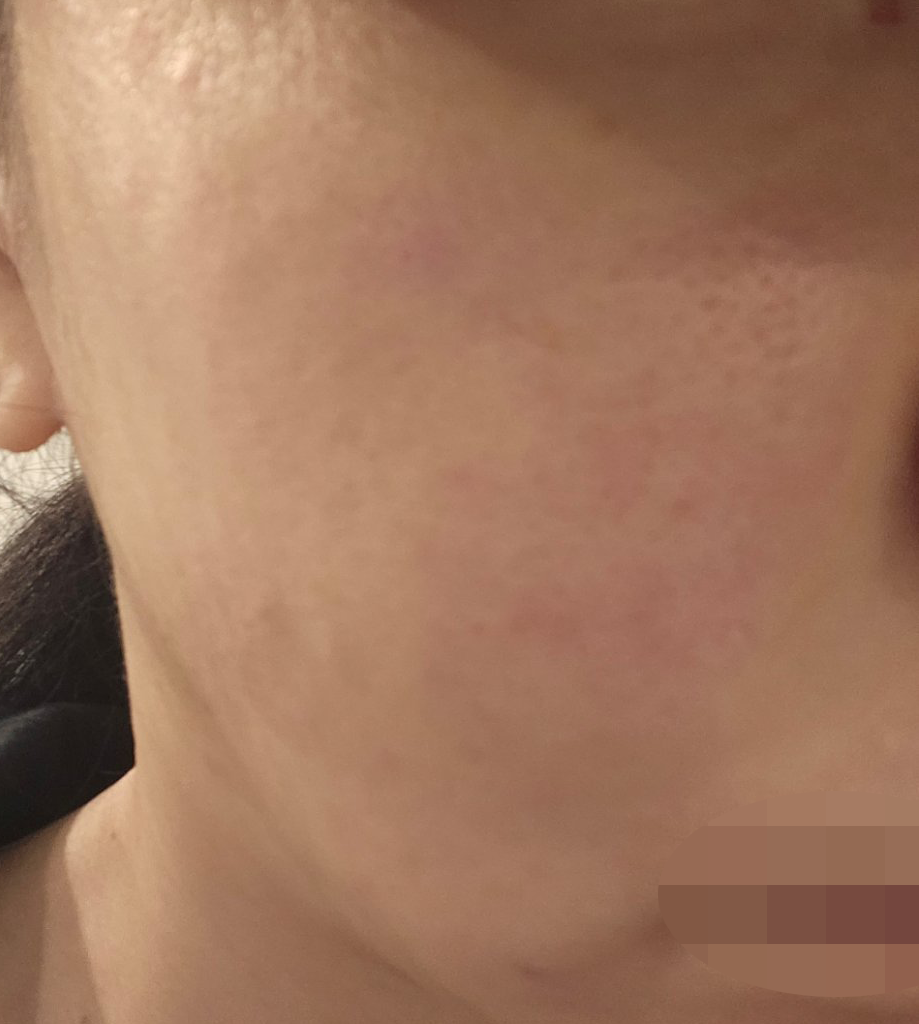 수술후기이미지