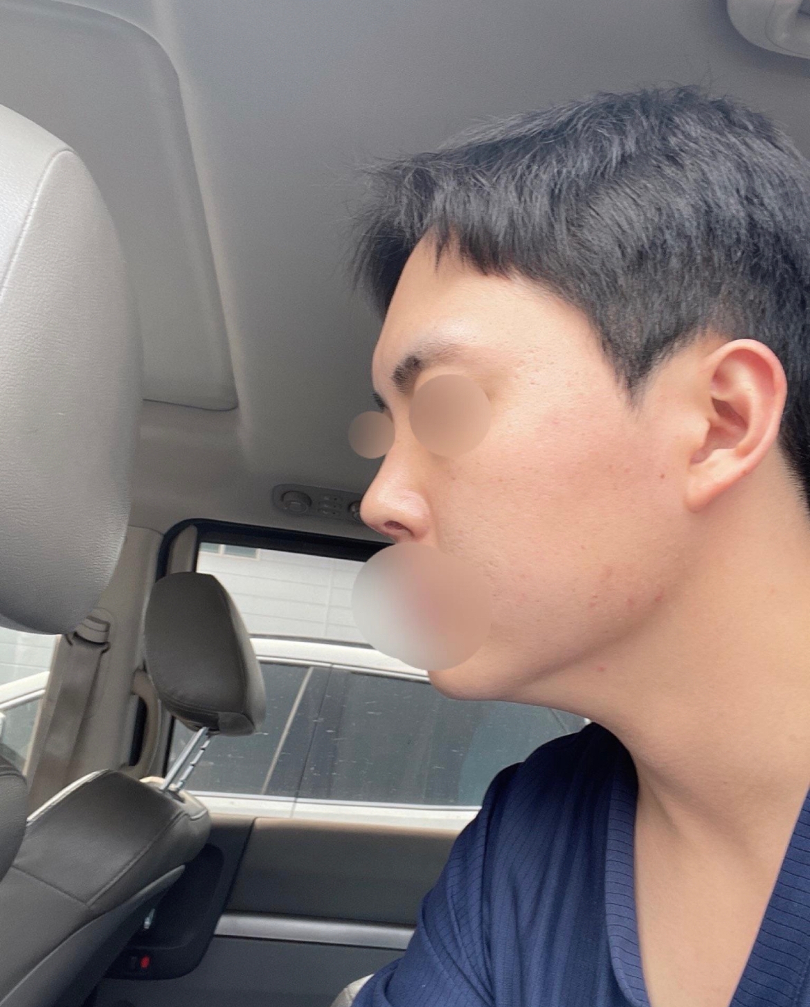 수술후기이미지