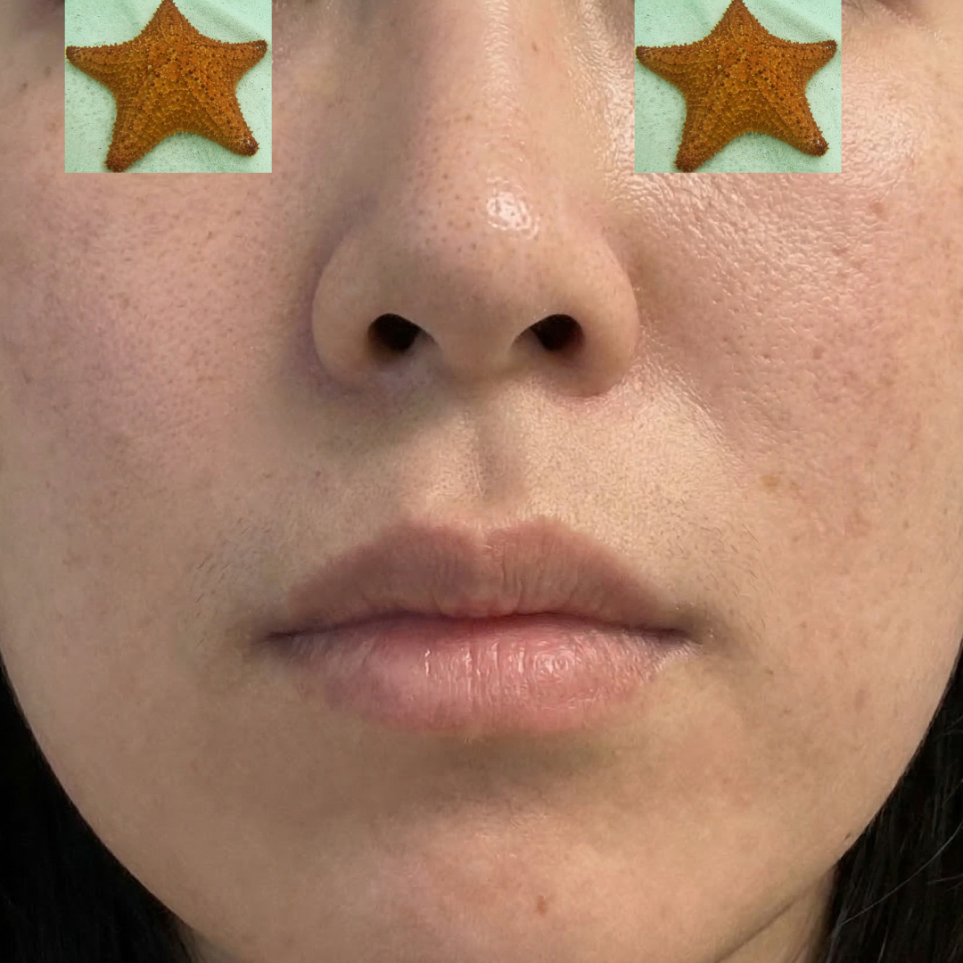 수술후기이미지