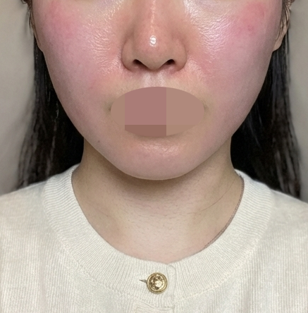 수술후기이미지