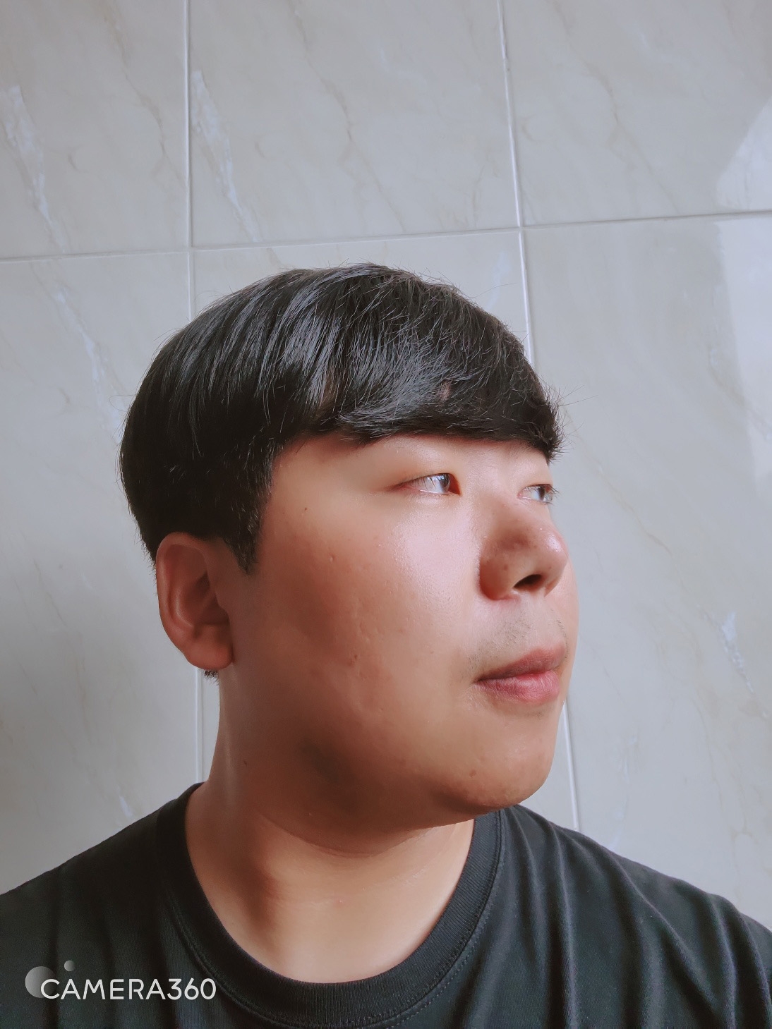 수술후기이미지