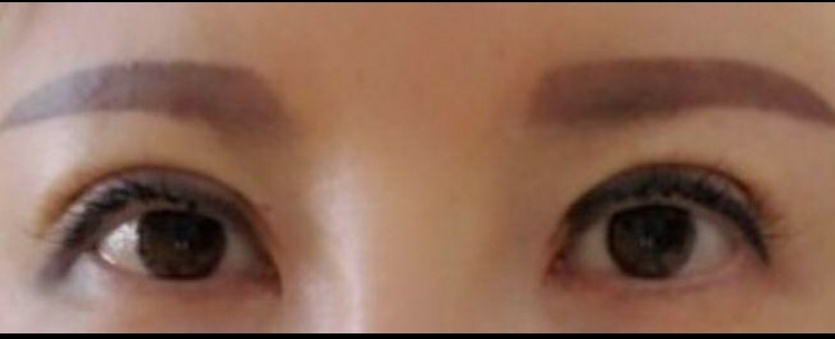 수술후기이미지