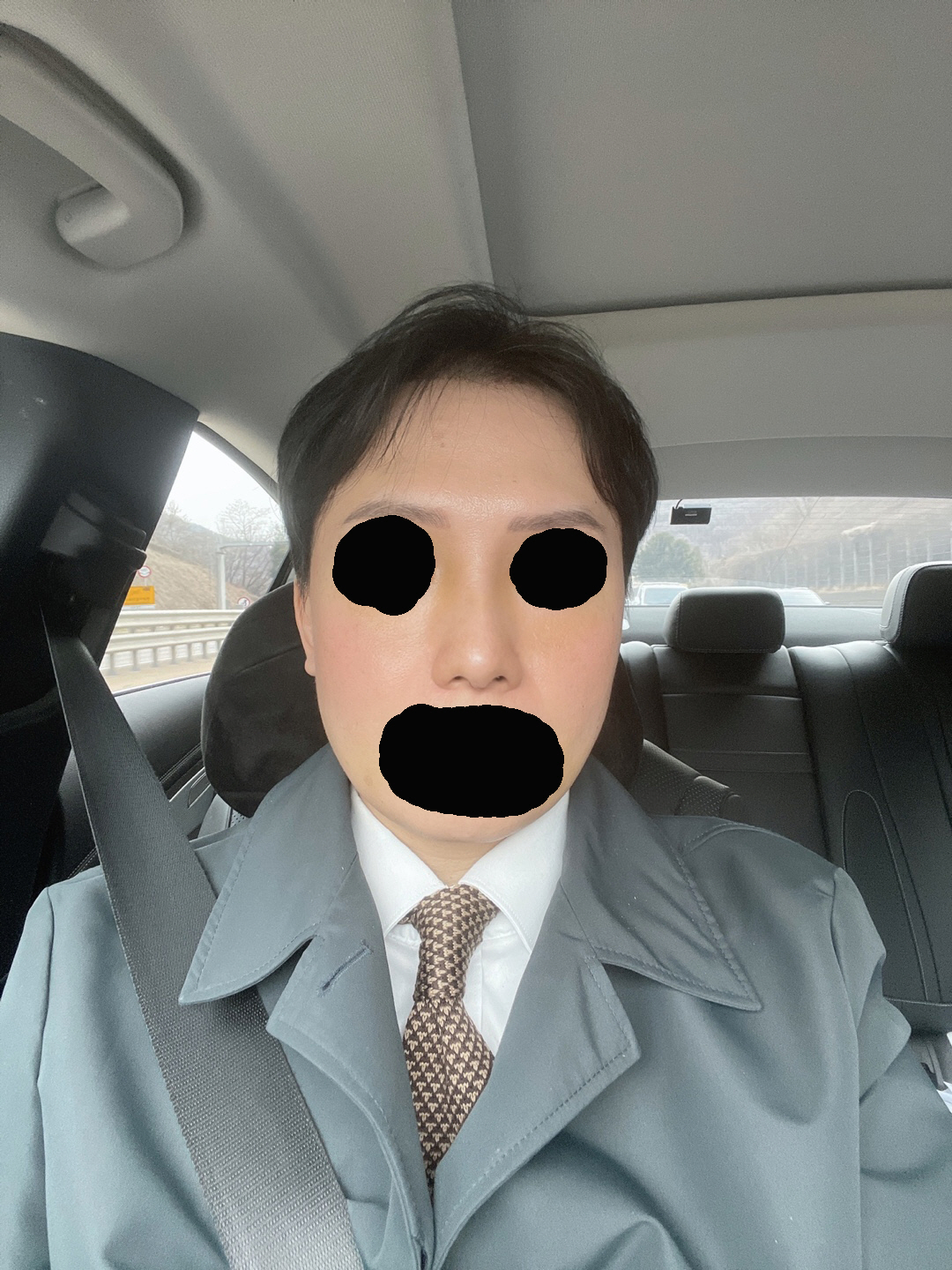 수술후기이미지